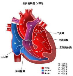 心臟病的診斷方法有哪些呢