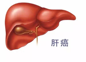 肝腫瘤有哪些治療方法