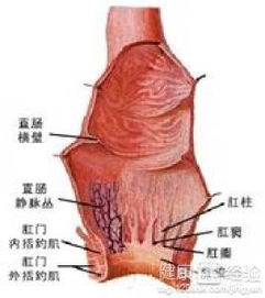 直腸造口注意事項(xiàng)