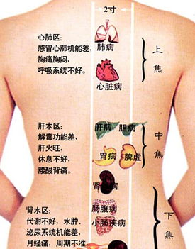 背部刮痧后要注意事項