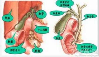 陰囊,結(jié)石,注意事項,飲食