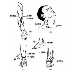 深靜脈注射后注意事項(xiàng)