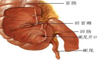 闌尾,人手,術(shù)前,注意事項(xiàng)