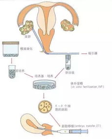 試管與自然懷孕注意事項(xiàng)