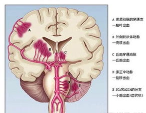 腦出血患者鼻飼注意事項(xiàng),腦出血昏迷鼻飼注意事項(xiàng),鼻飼的護(hù)理和注意事項(xiàng)