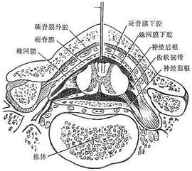 脊椎麻醉后注意事項(xiàng),脊椎正骨后的注意事項(xiàng),脊椎復(fù)位后注意事項(xiàng)