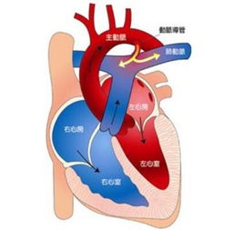 嬰兒肺動脈高壓應(yīng)注意事項