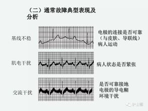 上心電監(jiān)護(hù)的注意事項(xiàng)