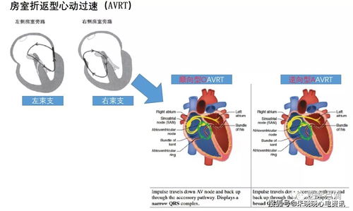 心電圖基礎(chǔ)知識網(wǎng)頁